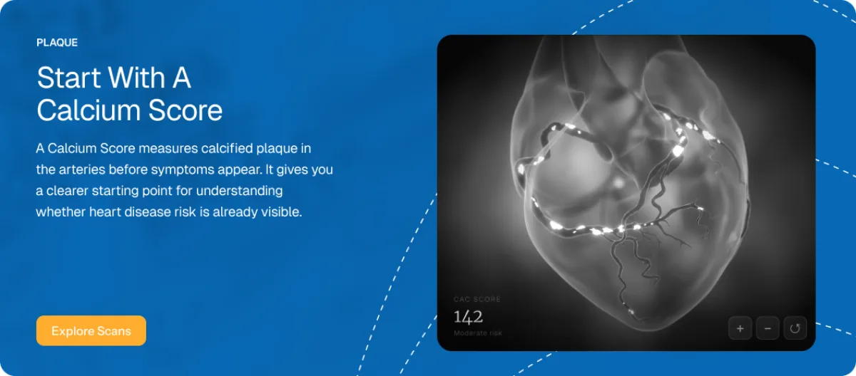 Calcium score preview showing visible plaque and a score of 142
